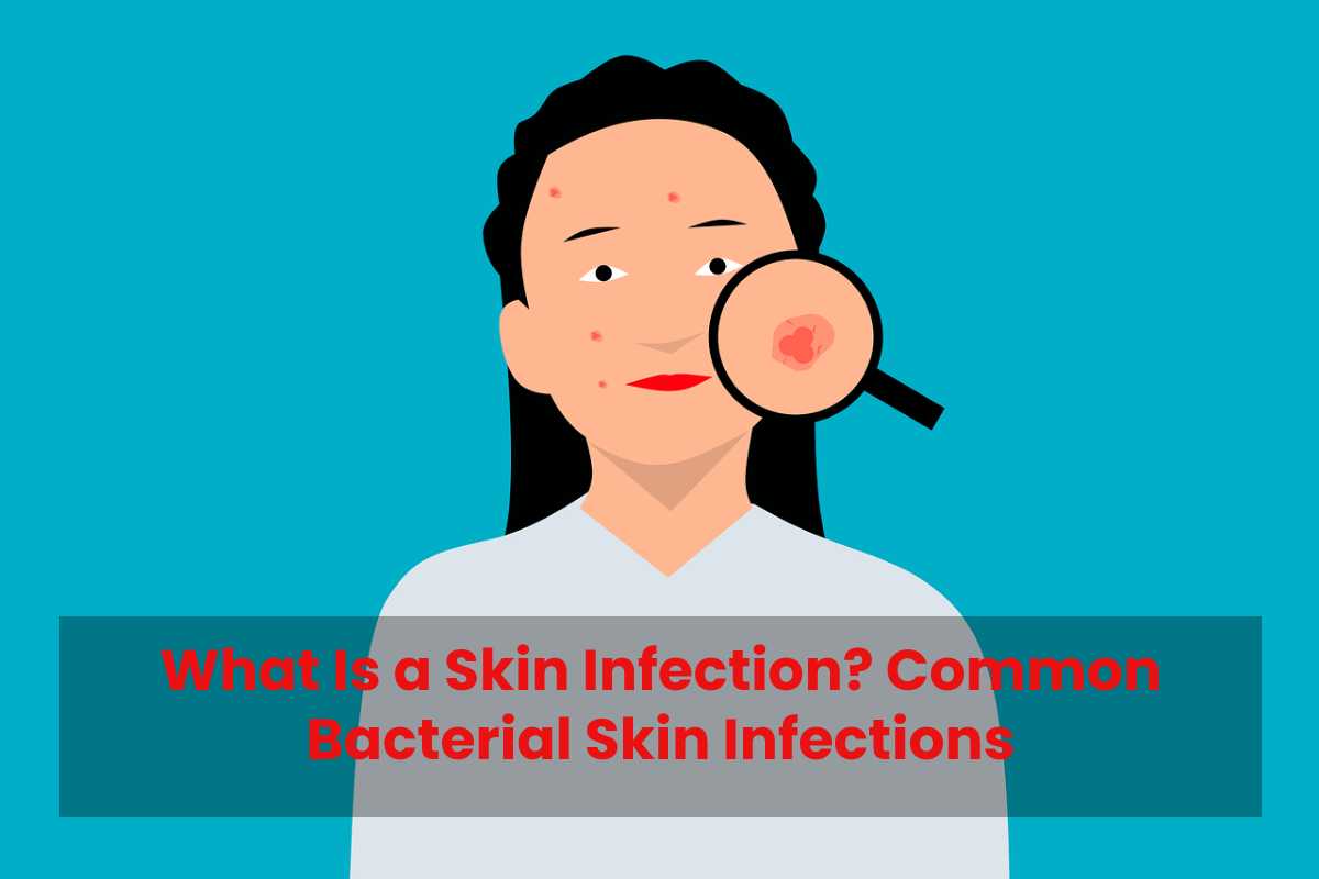 what-is-a-skin-infection-common-bacterial-skin-infections